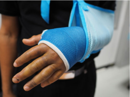 person with broken arm in cast, Riverdale personal injury lawyer concept